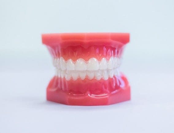 Invisalign
